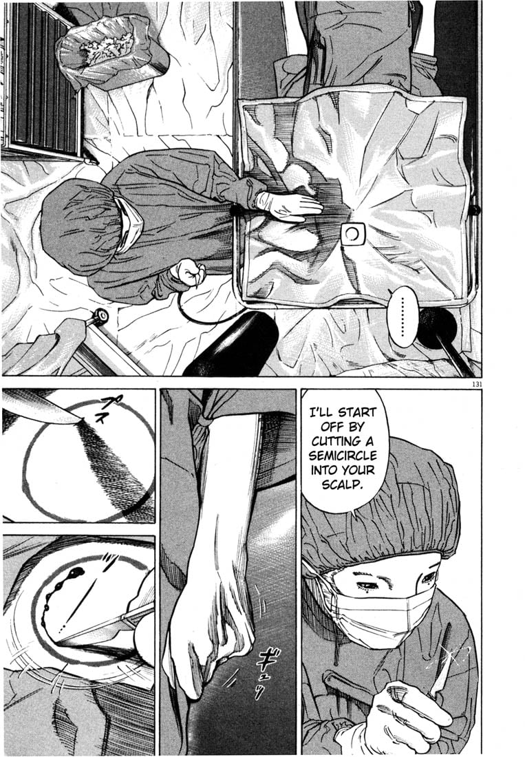 Read Homunculus en Manga Online