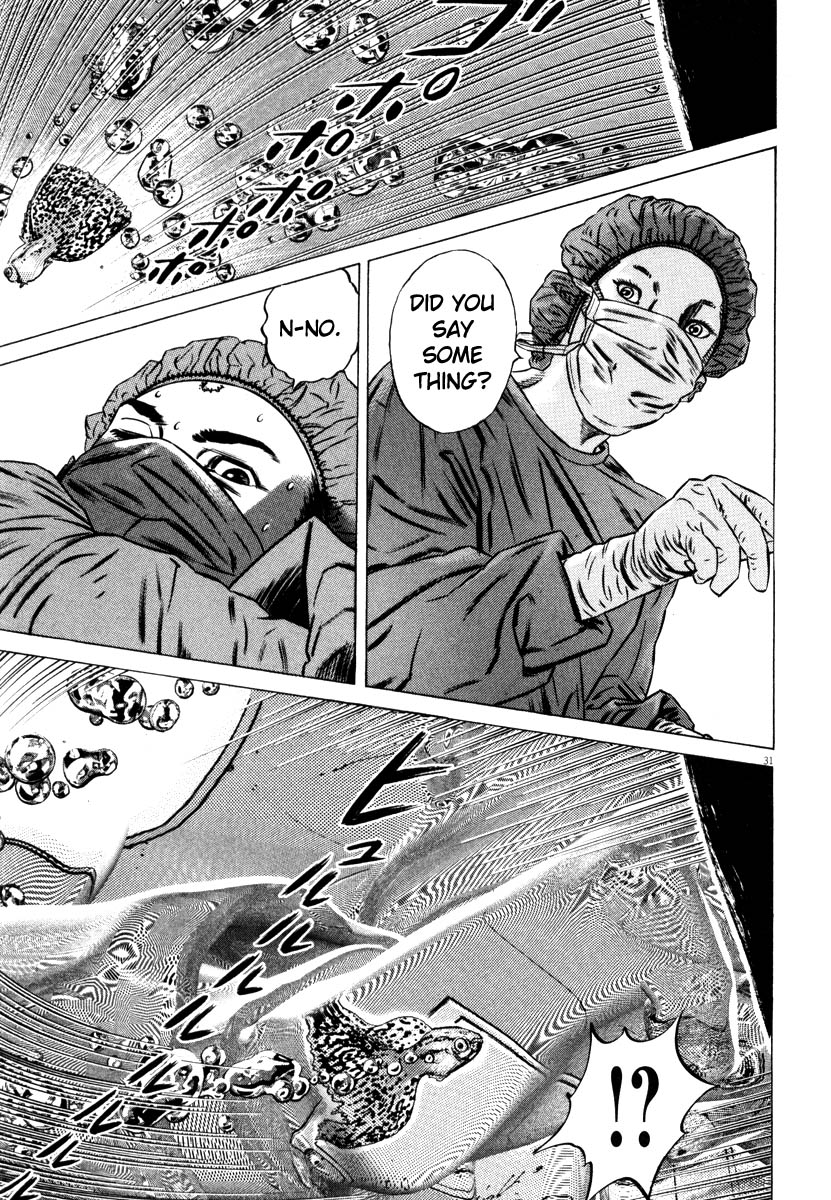 Read Homunculus en Manga Online