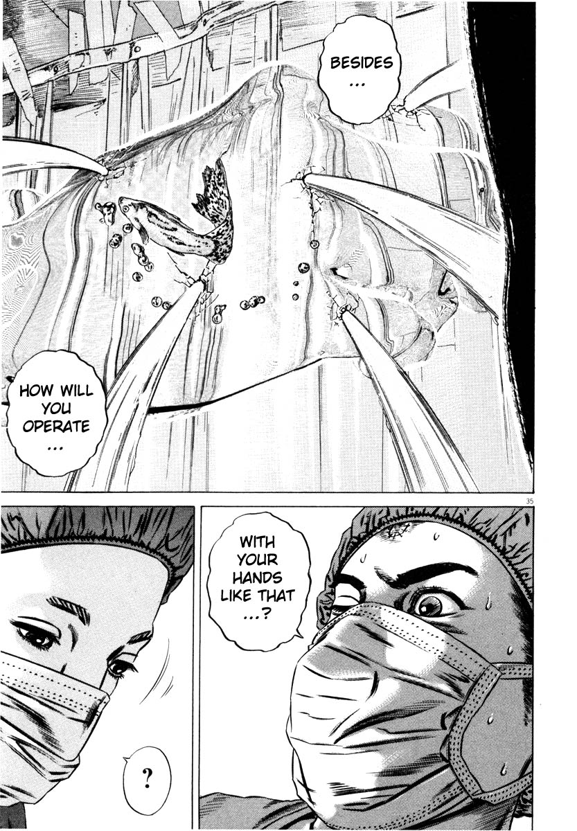 Read Homunculus en Manga Online